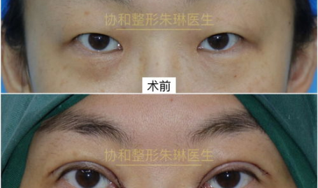 开眼角北京,探寻古都新韵,品味生活百态